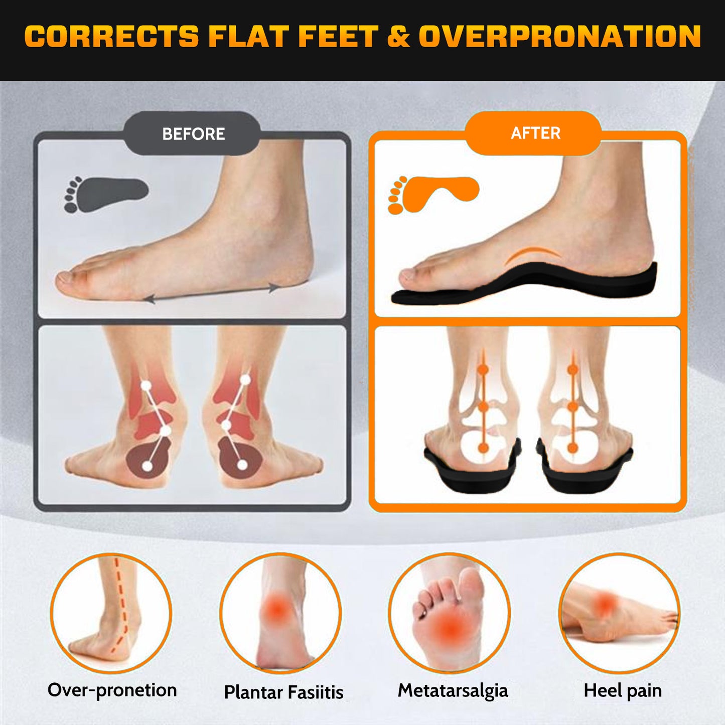 TERO Rostory Orthopedic Winter Shoes - Walk Pain-Free All Winter