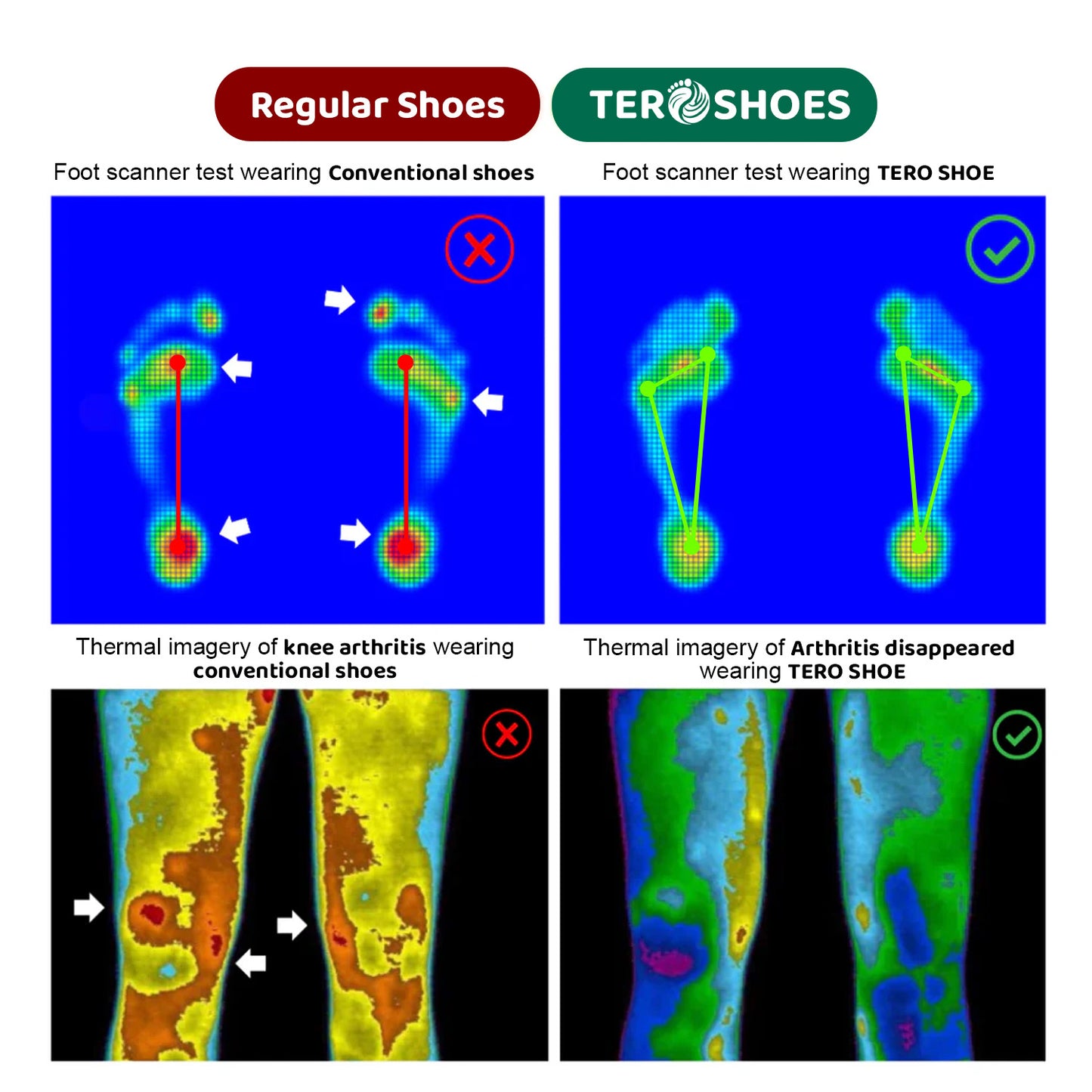 ❄️ Christmas Limited Offer 70% 💥 TERO Zeroxis Copper Grounding Barefoot Shoes