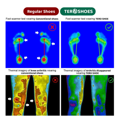 ❄️ Christmas Limited Offer 70% 💥 TERO Zeroxis Copper Grounding Barefoot Shoes